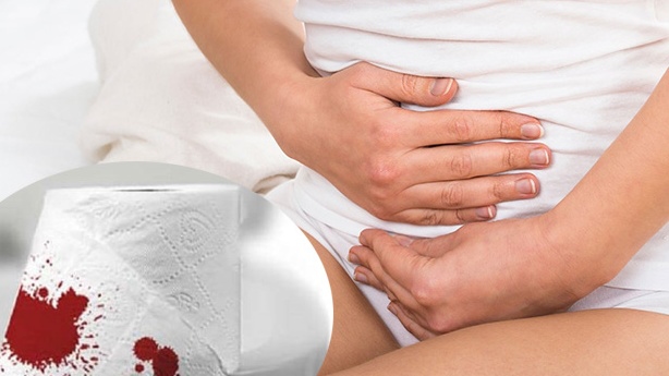 Bleedingby Anal Disorders: Understanding the Symptom and Booking Effective Treatment with StrongBody AI