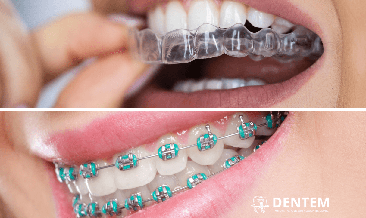 Orthodontics & Smile Aesthetics Clinic 2
