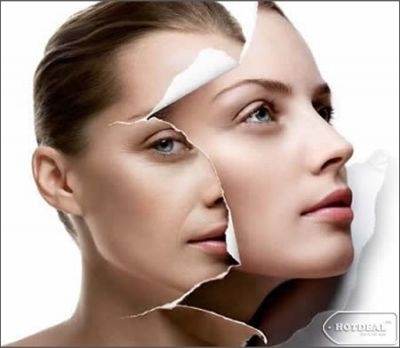 Trattamento di ringiovanimento cutaneo con tecnologia Laser & PRP