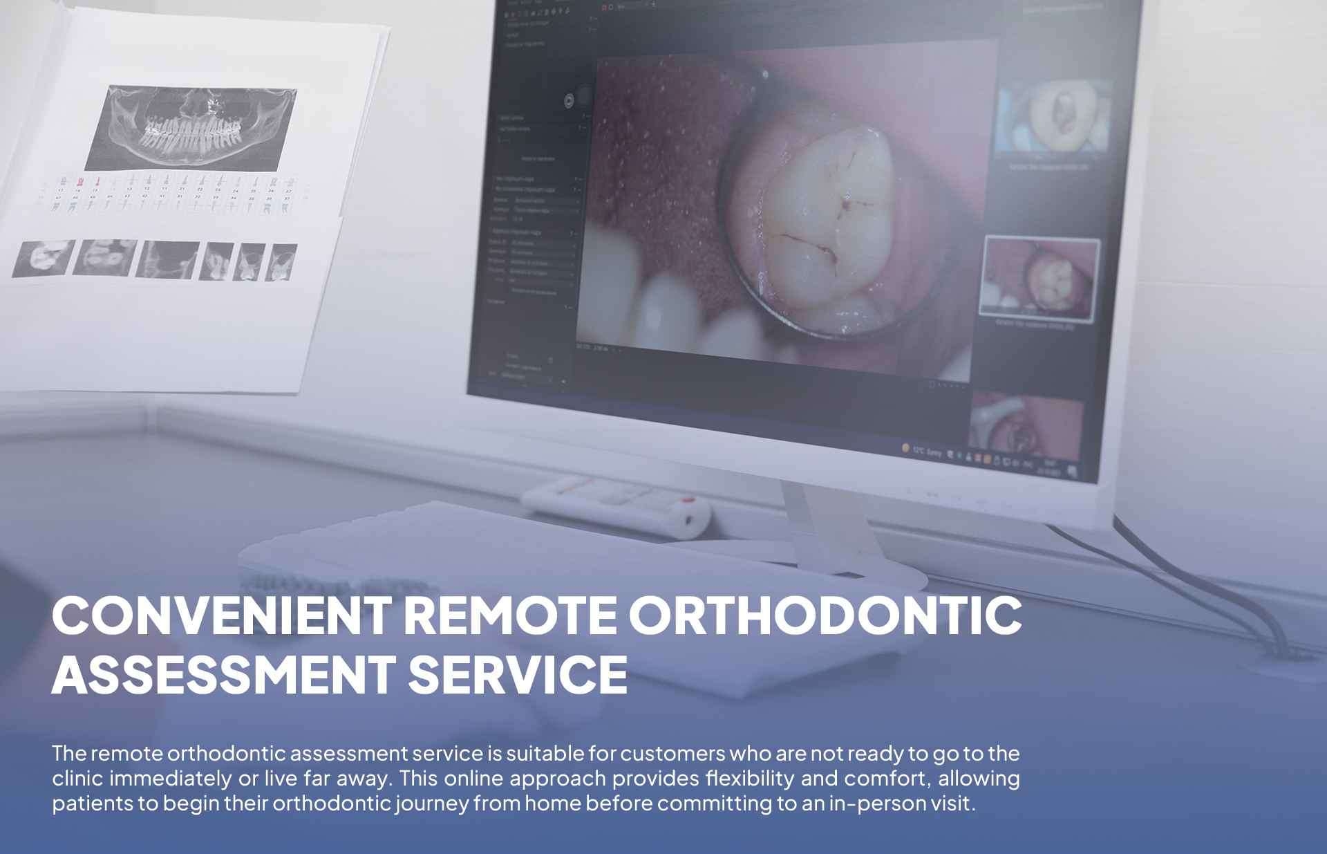 Remote orthodontic assessment 2
