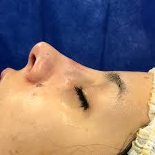 Cirugía estética
