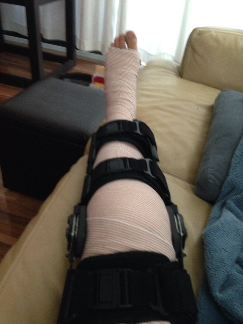 Sports Injury Rehabilitation Consultation