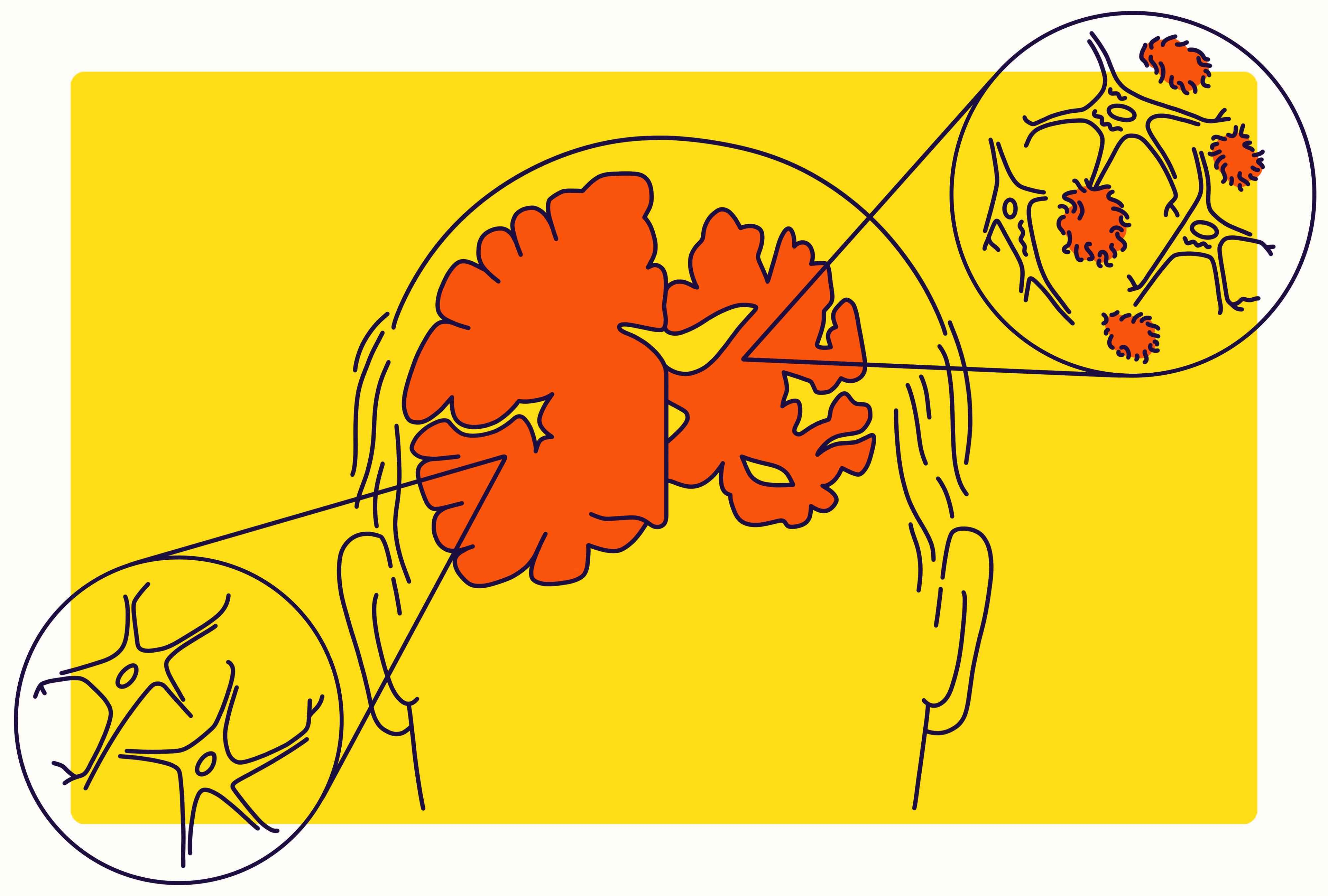 Alzheimer Home Care Assessment & Support