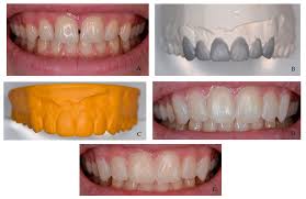 General Dental Examination & Treatment with Personalized Smile Design
