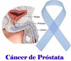  Salud prostática sin tabúes