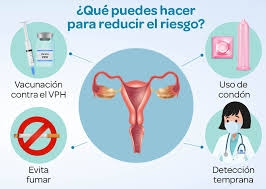 Detección y orientación personalizada sobre el cáncer de cuello uterino 2