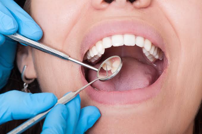 Oral care 