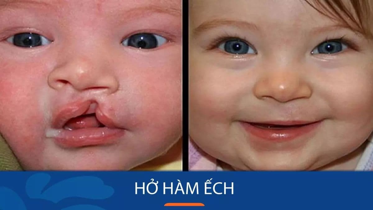 Fetal Defects: Early Detection, Timely Intervention