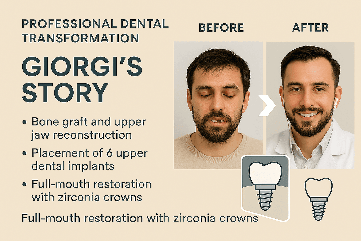 Smile Reconstruction After Tragedy - A Patient's Experience with Full Mouth Reconstruction Following a Car Accident