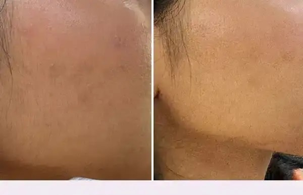 Online Dermatology Consultation